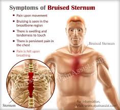 Pin On Chest Pain