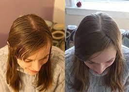 den schalter umzudrehen und die haare mit natron und apfelessig zu waschen sollte nur einen monat dauern aber jetzt kann ich nicht mehr aufh haare waschen mit natron haare naturlich waschen