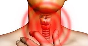 Feels Like Bone Is Stuck In My Throat Hyperthyroidism Thyroid Hypothyroidism