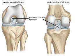 Maybe you would like to learn more about one of these? Posterior Cruciate Ligament Tears From Diagnsosis To Treatment