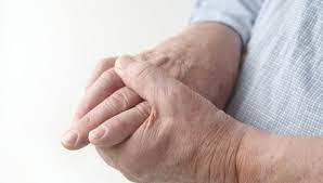 Wie Wird Eine Fruhe Rheumatoide Arthritis Festgestellt
