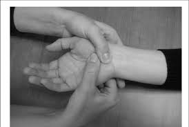Image result for Carpal Compression Test