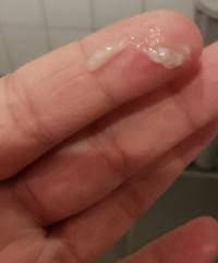Vorsicht Bild Ist Das Was Vom Schleimpfropf Forum Schwangerschaft Urbia De