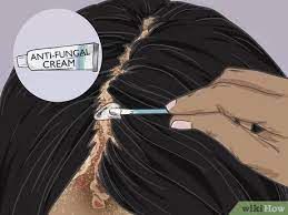 Combination of antifungal medication (natamycin) and prebiotic in a vaginal suppository provides. 3 Ways To Grow Hair Back After A Scalp Fungal Infection Wikihow