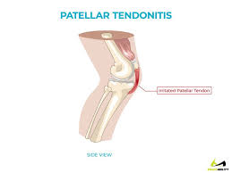 Pin On Exercise