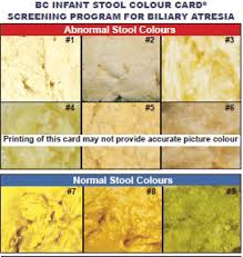 Image result for acholic stools human