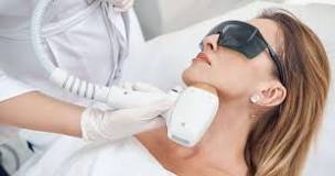 El efecto rebote en la depilación láser, ¿es real?