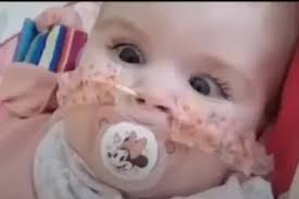 Papa Francisco reza por Indi Gregory, menina que foi removida do suporte de  vida