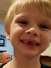 Losing someone affects your smile