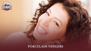 PORCELAIN VENEERS