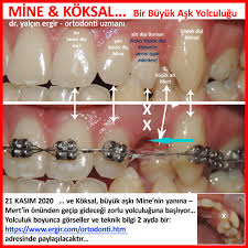 Dus Hekimi Yalcin Ergir Mine Koksal Bir Buyuk Ask Yolculugu Filmi Bilim Kismi Yolculuk Boyunca Gorseller Ve Teknik Bilgi 2 Ayda Bir Https Www Ergir Com Ortodonti Htm Adresinde Paylasilacaktir Oyuncular Mine Narin Romantik Minyon