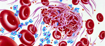 Image result for Anticoagulation