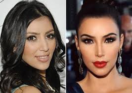 Kim Kardashian Before And After Nose Job Nose Job Kardashian Plastic Surgery Kim Kardashian Before