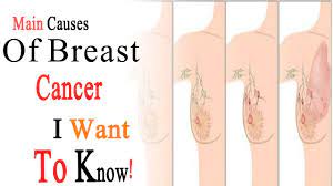 You have a higher chance of having breast cancer if Main Reason Of Breast Cancer Can Being Pregnant Cause Breast Cancer How Do You Keep Your Breasts Healthy Steemkr
