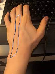 Hand Krampf Beim Zocken Pc Gesundheit Gaming