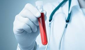 Butalbital-Acetaminophen-Caffeine (Fioricet)