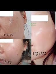 If you feel a warm sensation on your skin, it is suggested to use a cool towel to. Incellderm Dermatology First Package Booster 120ml And Serum 45ml Shop Reviews