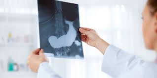 Your diet plays a role in a healthy immune system. 5 Warning Signs Your Pancreas Is In Trouble Prevention