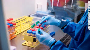 Experts warn that vaccine may only be 'partially effective' after results of a trial in rhesus macaque monkeys. Oxford S Covid 19 Vaccine Could Do More For The World Than Other Shots Cnn