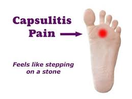 Pin On Healthy Feet