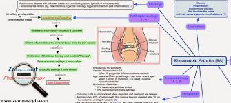 72 conclusive pathophysiology of arthritis in flow chart