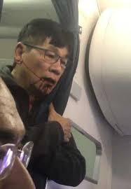 United Airlines under fire after passenger dragged from plane