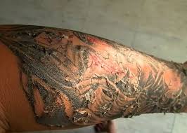 Clean the tattoo and the skin around it in the sink or shower. Tattoo Healing Process Stages Day By Day Aftercare Timeline 2021 Healing Tattoo Tattoo Healing Process Tattoo Healing Stages
