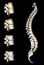 Exploring The Different Stages Of Degenerative Disc Disease