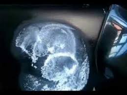 Turn the hair dryer off. Car Dent Removal With Hair Dryer And Compressed Air Youtube