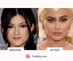 She's used to defending herself from not long ago, kyle' nose was a lot different in shape and size. Kylie Jenner Plastic Surgery Before And After Images 2021