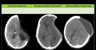 Pin By Koulla On Neurologia Radiology Imaging Nursing Information Radiology