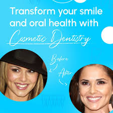 Dentistry is love .... Cosmetic Restoration
