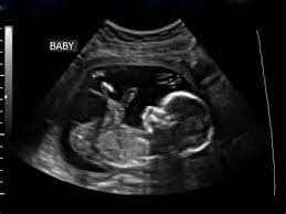 Unfollow baby scan picture to stop getting updates on your ebay feed. Baby Ultrasound Pictures Baby Ultrasound Baby Ultrasound Pictures Ultrasound Pictures