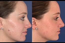 Primary Skin Lesions