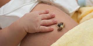 Sepanjang belum terlepas, orang tua bayi perlu menjaga area tersebut tetap bersih dan kering. Tali Pusat Bayi 3 Komplikasi Yang Berbahaya Dan Boleh Berlaku Semasa Bersalin Theasianparent Malaysia