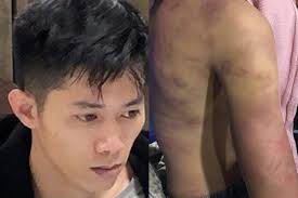 Hành động của cô gái váy xám khiến cư dân mạng xôn xao, xem như chẳng khác nhân vật lục nói về lý do xông vào đánh người đàn ông, n.h.n cho biết chỉ vô tình vướng vào vụ đánh ghen: Vá»¥ Be Gai 12 Tuá»•i Bá»‹ Báº¡o Hanh Xam Háº¡i Tinh Dá»¥c á»Ÿ Ha Ná»™i Nghi Pháº¡m Tá»«ng Thá» Thá»'t Khong Lam Ä'iá»u Ac