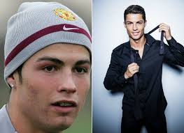 Криштиану роналду до и после пластических операций 2. Iz Gadkogo Utenka V Prekrasnogo Princa 10 Znamenityh Muzhchin Pribegnuvshih K Plastike