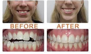 Ask a question about working or interviewing at perfect smile dental care. Viva Smiles 9639 Chapman Ave Garden Grove Ca 92841 Usa
