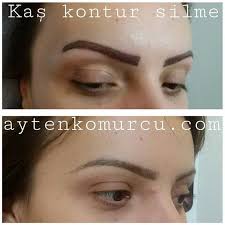 Kas Konturu Silme Islemi Oncesi Ve Sonrasi Kas Makyaj