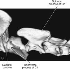 We did not find results for: The Canine And Feline Vertebrae Veterian Key