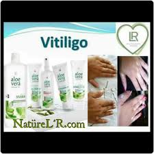 Https Www Facebook Com Naturelr Guzellik