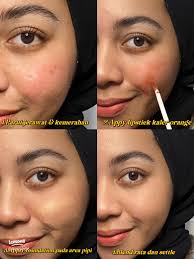 Cara Efektif Menutup Parut Jerawat dengan Lipstick
