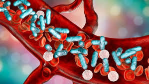 Almost any type of infection can lead to sepsis. Sepsis Post Sepsis Syndrome And Infection Control