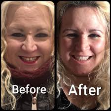 Dent'Hell : Les DENTS de la Maud