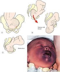 Image result for Face Presentation