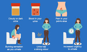 Female Utis Your Burning Questions Answered Health Plus