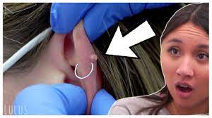 Cartilage Piercing Removal Warning Pus Youtube