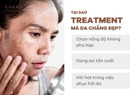 Các Bước Chăm Sóc Da Treatment Đúng Cách – Zakka Naturals