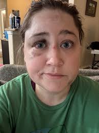 Fundraiser by Wendy Williams : Help Wendy Rebuild After Escaping Abuse