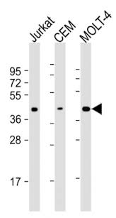 Dylight 550 amax= 562 nm. Ada Antibody Mybiosource
